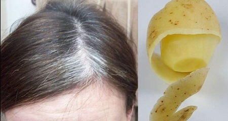 رشد سریع مو با سیب زمینی,درمان ریزش مو با سیب زمینی