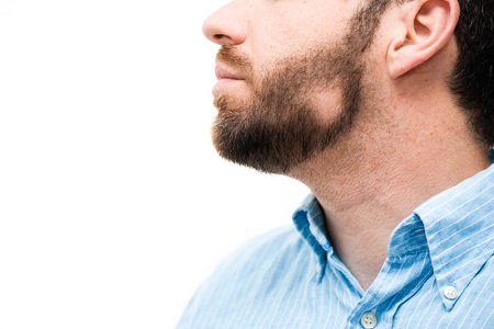 علت ریزش ریش, دلایل ریزش ریش صورت, درمان ریزش ریش